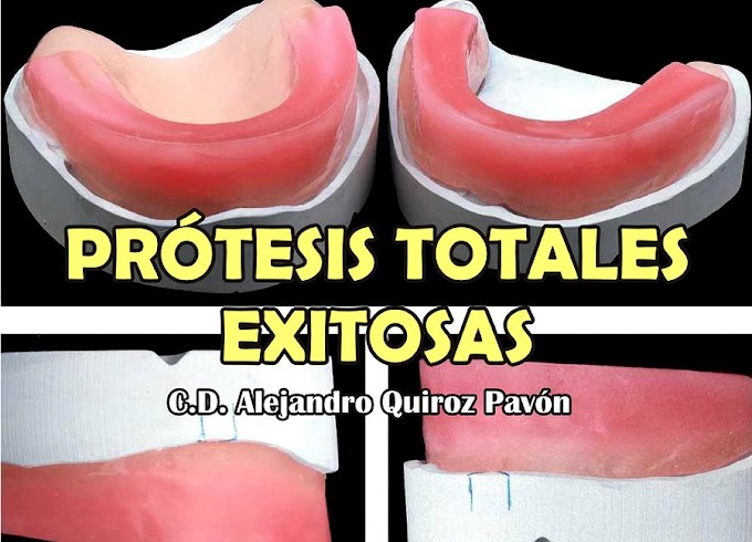 PRÓTESIS TOTALES exitosas - C.D. Alejandro Quiroz Pavón