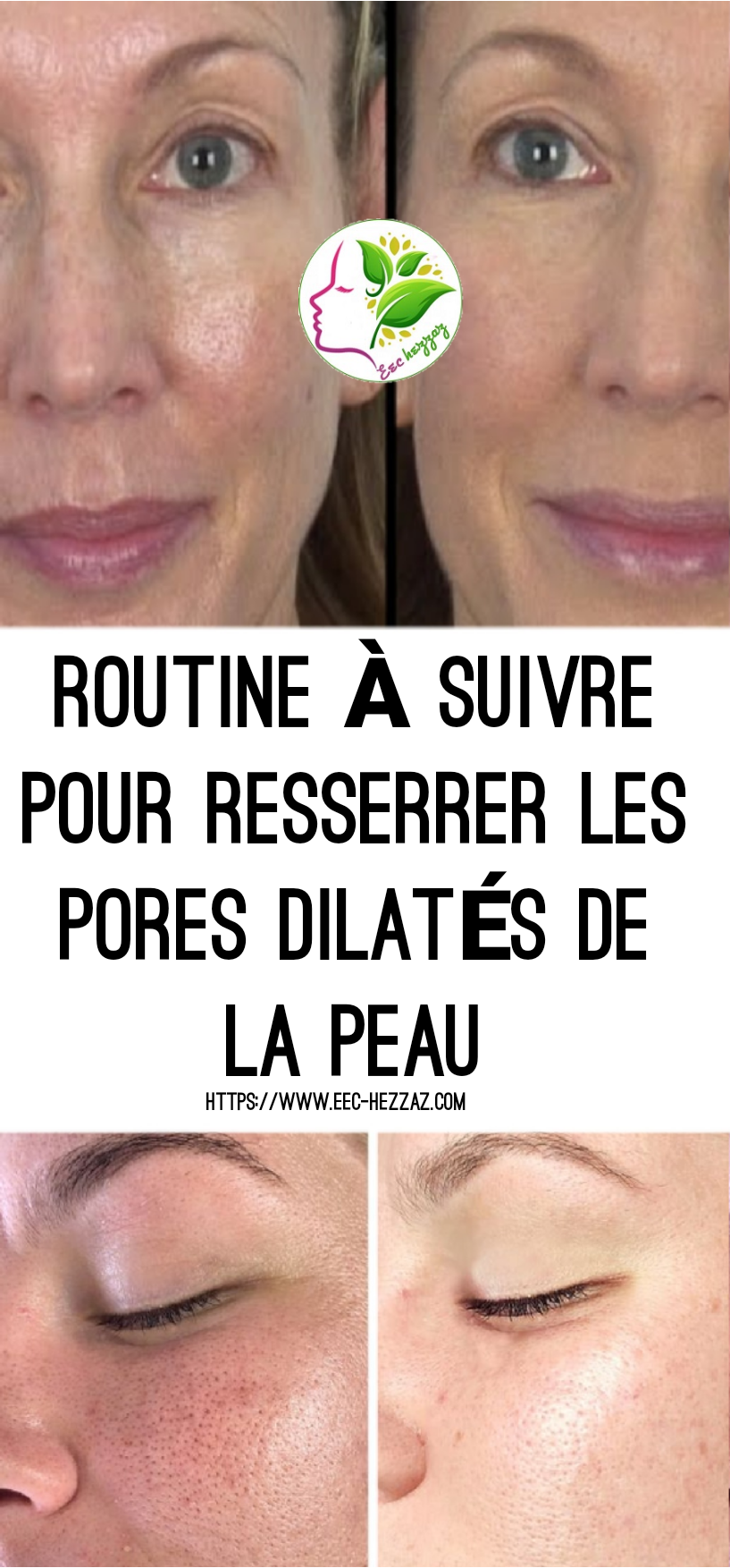 Routine à suivre pour resserrer les pores dilatés de la peau