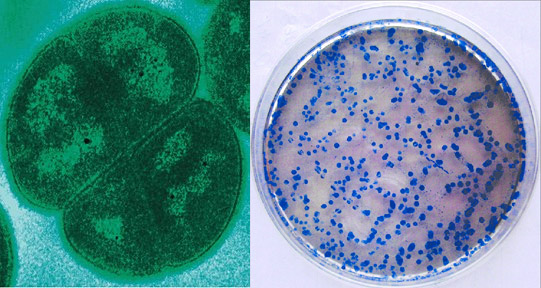 Deinococcus radiodurans (à esquerda) e Streptococcus mitis (à direita) - bactérias que podem sobreviver no vácuo do espaço