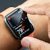 رصد Apple Watch PRODUCT RED لفترة وجيزة، وستصل على الأرجح في فصل الربيع رصد Apple Watch PRODUCT RED لفترة وجيزة، وستصل على الأرجح في فصل الربيع