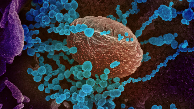 Una de las cosas más extrañas del coronavirus, según científicos