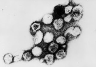 Kızamıkçık virüsü (Rubella virüsü)
