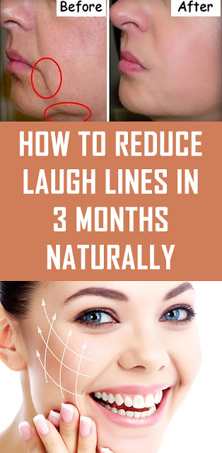 How to Reduce Laugh Lines in 3 Months Naturally