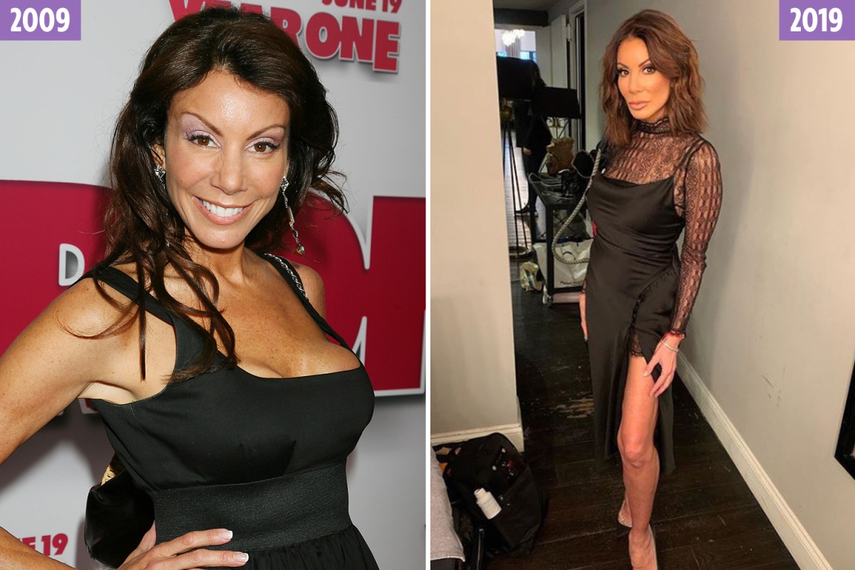 Danielle Staub is removing her breast implants, which she regrets. 