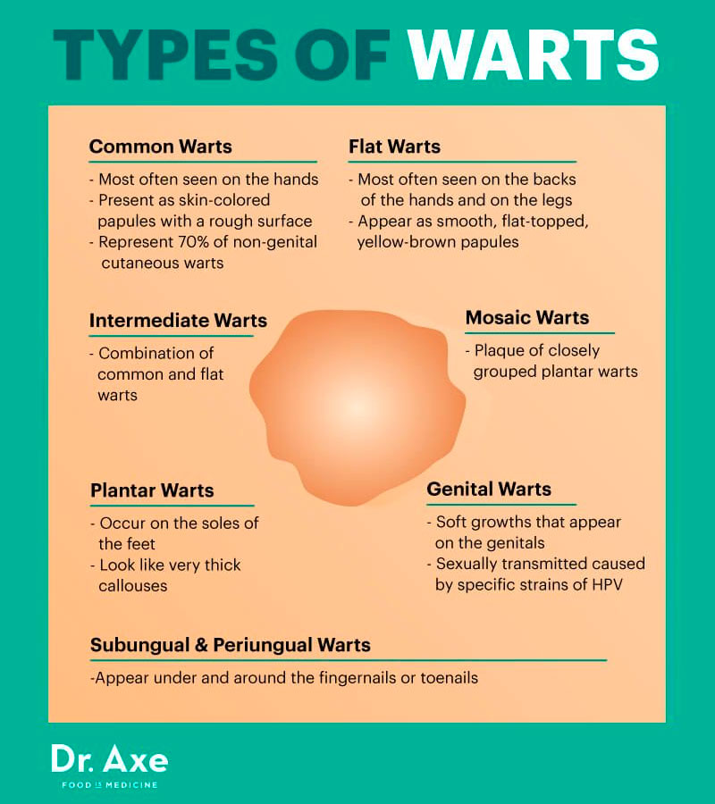 The Everything Health Blog Types Of Warts You Need To Know About