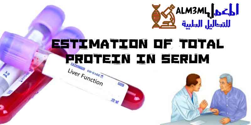 Estimation of total protein in serum Estimation of total protein in serum