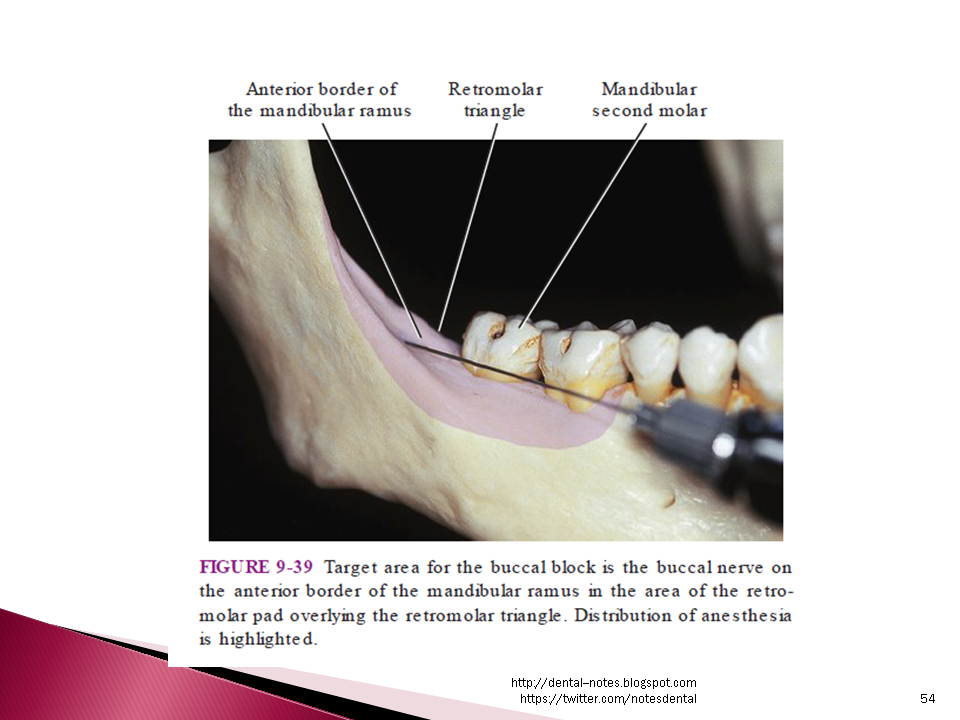 Dental Notes Long Buccal Nerve Block Notes My XXX Hot Girl