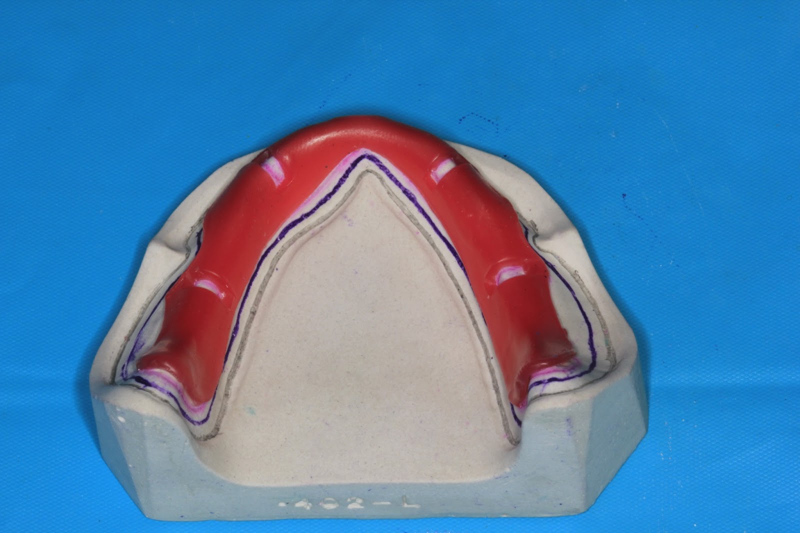 Understanding Prosthodontics Tagore Dental College & HospitalBy