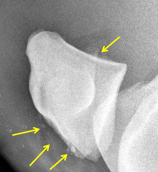 Michael Porter, Equine Veterinarian Fractured Patella in a Horse