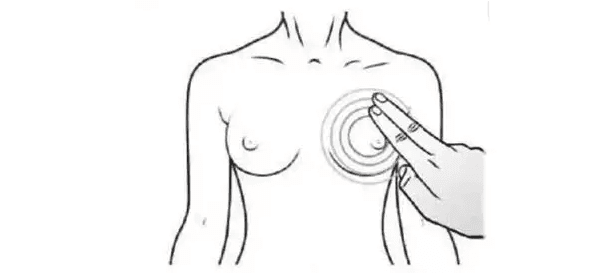 Some Diseases may Cause Breast Lump