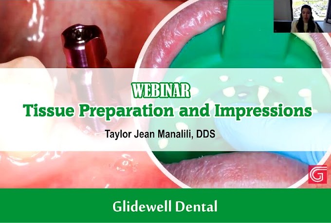 WEBINAR: Tissue Preparation and Impressions - Restoring Implants (Part 1) - Taylor Jean Manalili, DDS