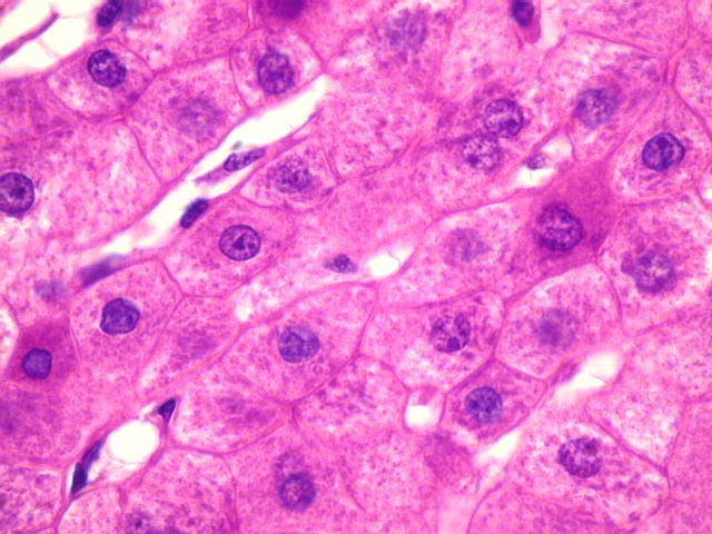 Иммунные клетки печени. Клетки печени гепатоциты. Клетки печени аксолотля гистология. Морфология клетки печени аксолотля. Включения гликогена в гепатоцитах.