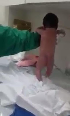 6 Newborn baby 'starts walking' minutes after being born in a Brazil hospital