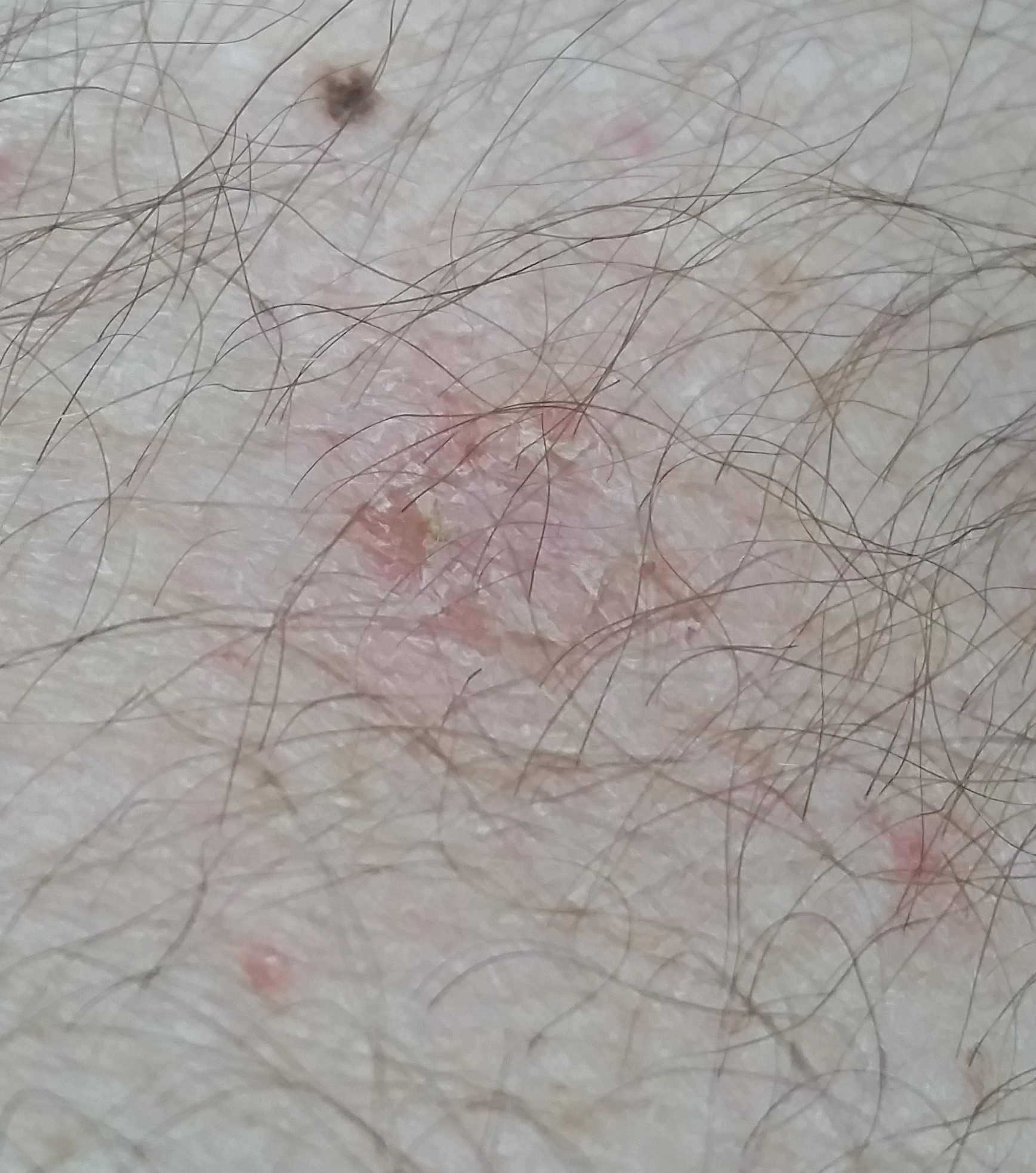 Cat Chit Chat Ringworm transmitted to cat owners from their cat can be