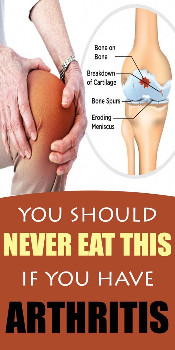 5 Foods You Should Never Eat If You Have Arthritis