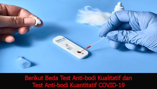 Berikut Beda Test Anti-bodi Kualitatif dan Test Anti-bodi Kuantitatif COVID-19