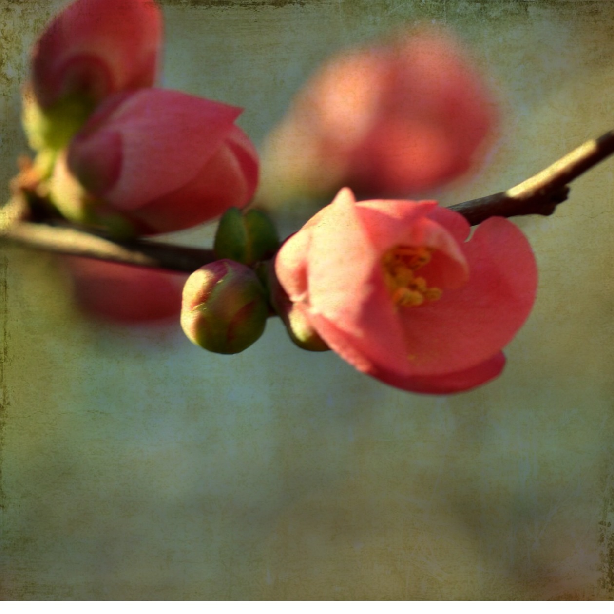 Mastectomy Simple Mastectomy