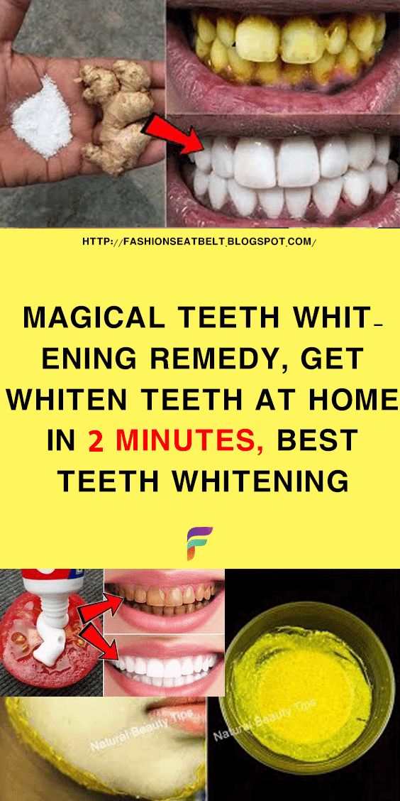 Magical Teeth Whitening Remedy, Get whiten Teeth at home in 2 minutes, Best Teeth Whitening