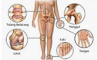 Cara Menurunkan Asam Urat Yg Cepat, Nilai Normal Asam Urat Lansia, Bagaimana Mengatasi Asam Urat Dan Kolesterol, Www.Cek Asam Urat, Tips Cara Cepat Mengobati Asam Urat, Labu Siam Untuk Asam Urat Dan Kolesterol, Obat Herbal Yang Bagus Untuk Asam Urat, Makanan Pantangan Asam Urat Dan Rematik, Cara Herbal Asam Urat, Obat Alami Untuk Gejala Asam Urat, Kadar Asam Urat Pada Gout, Asam Urat Dan Obat Alami, Resep Tradisional Asam Urat Dan Kolesterol, Asam Urat Dan Pengobatan Nya, Tanda2 Asam Urat Dan Cara Mengobatinya, Obat Asam Urat Generic, Download Aplikasi Asam Urat, Obat Alami Mengobati Asam Urat, Asam Urat Jangan Diurut, Asam Urat Tinggi Pada Ibu Hamil, Obat Untuk Mengobati Asam Urat, Cara Penyembuhan Asam Urat Secara Tradisional, Asam Urat Dalam Bahasa Kedokteran, Asam Urat Ceker Ayam, Kadar Asam Urat Normal Dlm Tubuh, Jamu Herbal Asam Urat Dan Kolesterol, Askep Gerontik Asam Urat Nanda Nic Noc, Buah Untuk Obat Asam Urat Alami, Penatalaksanaan Asam Urat Akut, Asam Urat Hindari, Buah Untuk Obat Asam Urat Dan Kolesterol, Obat Asam Urat Dan Pantangan Makan, Menghilangkan Sakit Karena Asam Urat, Tabel Cek Asam Urat, Cara Membuat Obat Herbal Penyakit Asam Urat, Obat Asam Urat Untuk Penderita Diabetes, Asam Urat Buah, Penyebab Rendahnya Asam Urat, Askep Asam Urat Yang Lengkap, Gejala Asam Urat Di Pinggang, Gejala Asam Urat Obatnya, Obat Asam Urat Kolesterol Dan Diabetes, Asam Urat Penyebab Dan Cara Mengatasinya, Obat Manjur Penyakit Asam Urat, Asam Urat Saat Hamil 