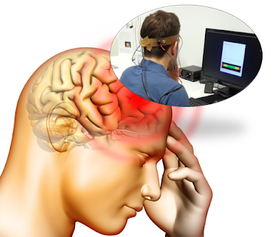 Scarf Mitarbeiterbefragung Zur Messung Der Anwendung Von