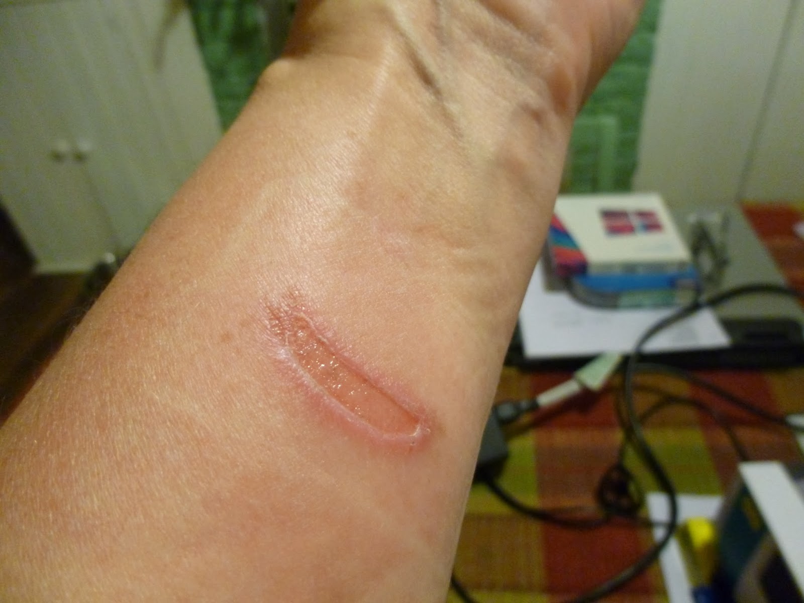 Our New Life in the Country Honey and Burns