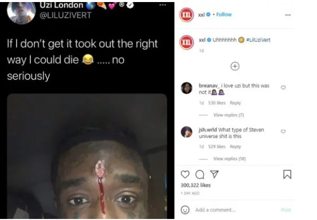 Lil Uzi Vert cries out after bleeding due to the diamond piercing he did on his forehead