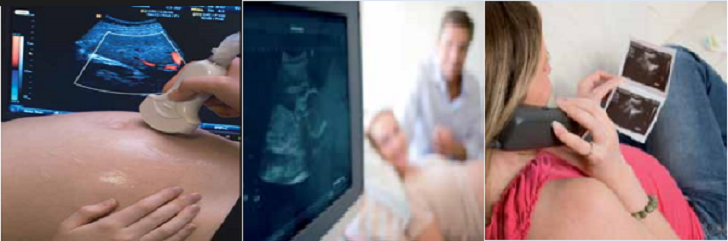 ULTRASOUND SCANS DURING PREGNANCY