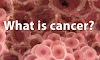 Cancer and its treatment: