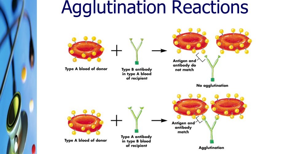 Lecture Notes in Medical Technology Lecture 2 ANTIGENANTIBODY REACTION IN BLOOD GROUP SEROLOGY
