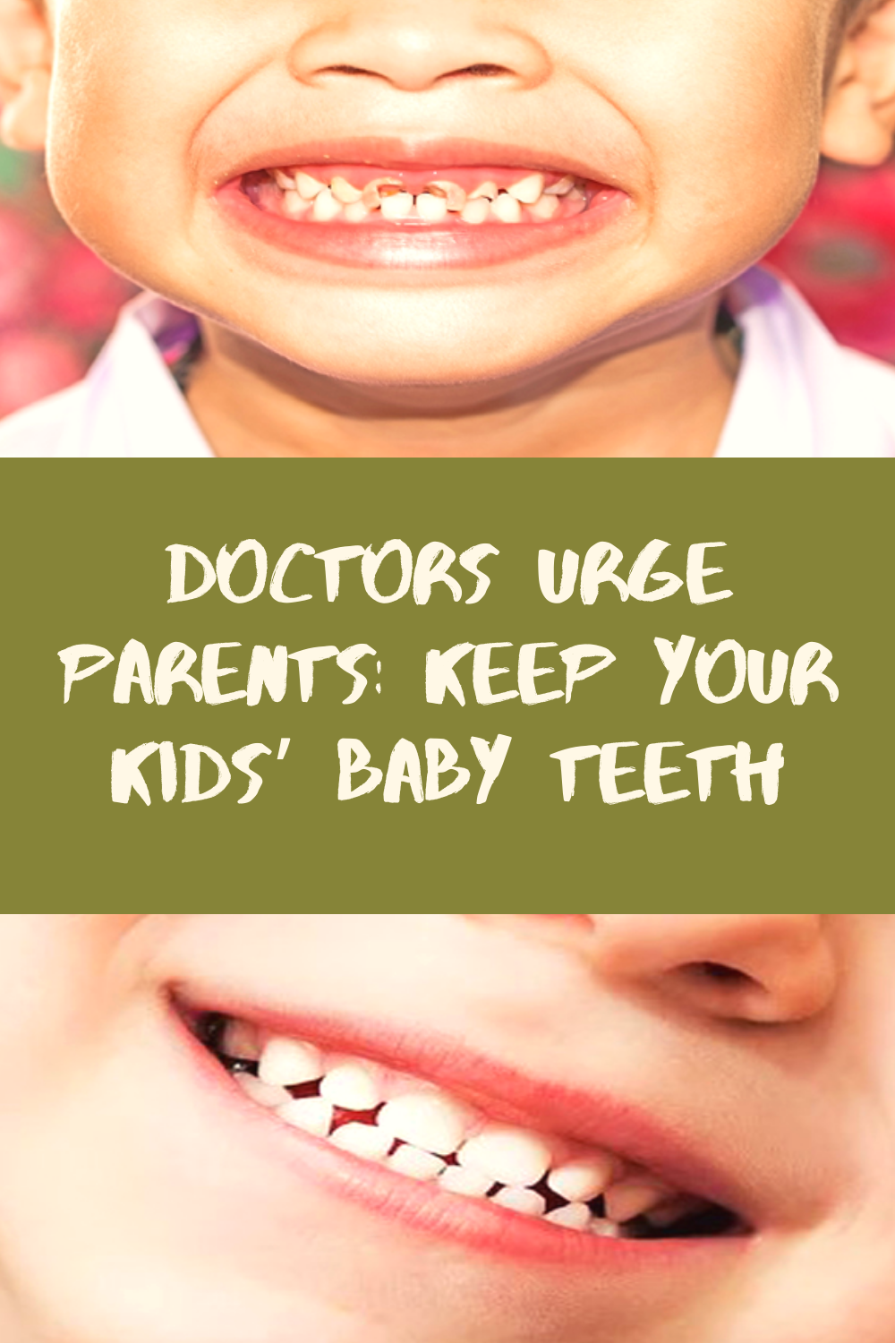 Doctors Urge Parents Keep Your Kids’ Baby Teeth