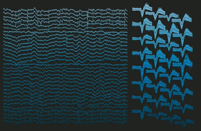 How Does Neuralink Understand the Brain - upside down blogger Neuralink's Brain Decoder