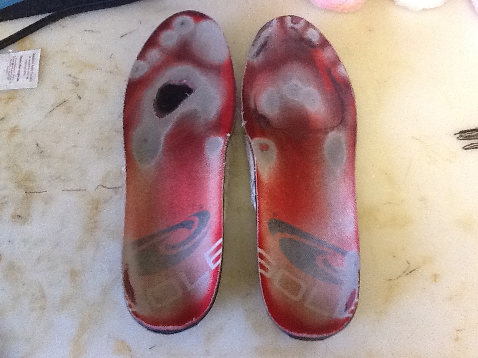 Foot and Ankle Problems By Dr. Richard Blake Insole Wear Patterns A