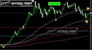 dx chart