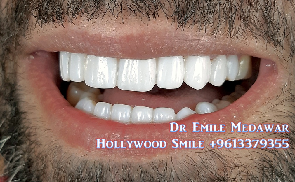 Dr Emile Medawar, Cosmetic Dentist, Dental Implants