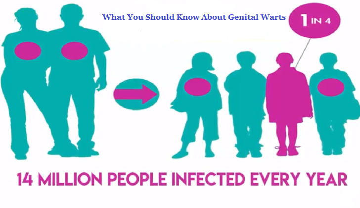 What You Should Know About Genital Warts
