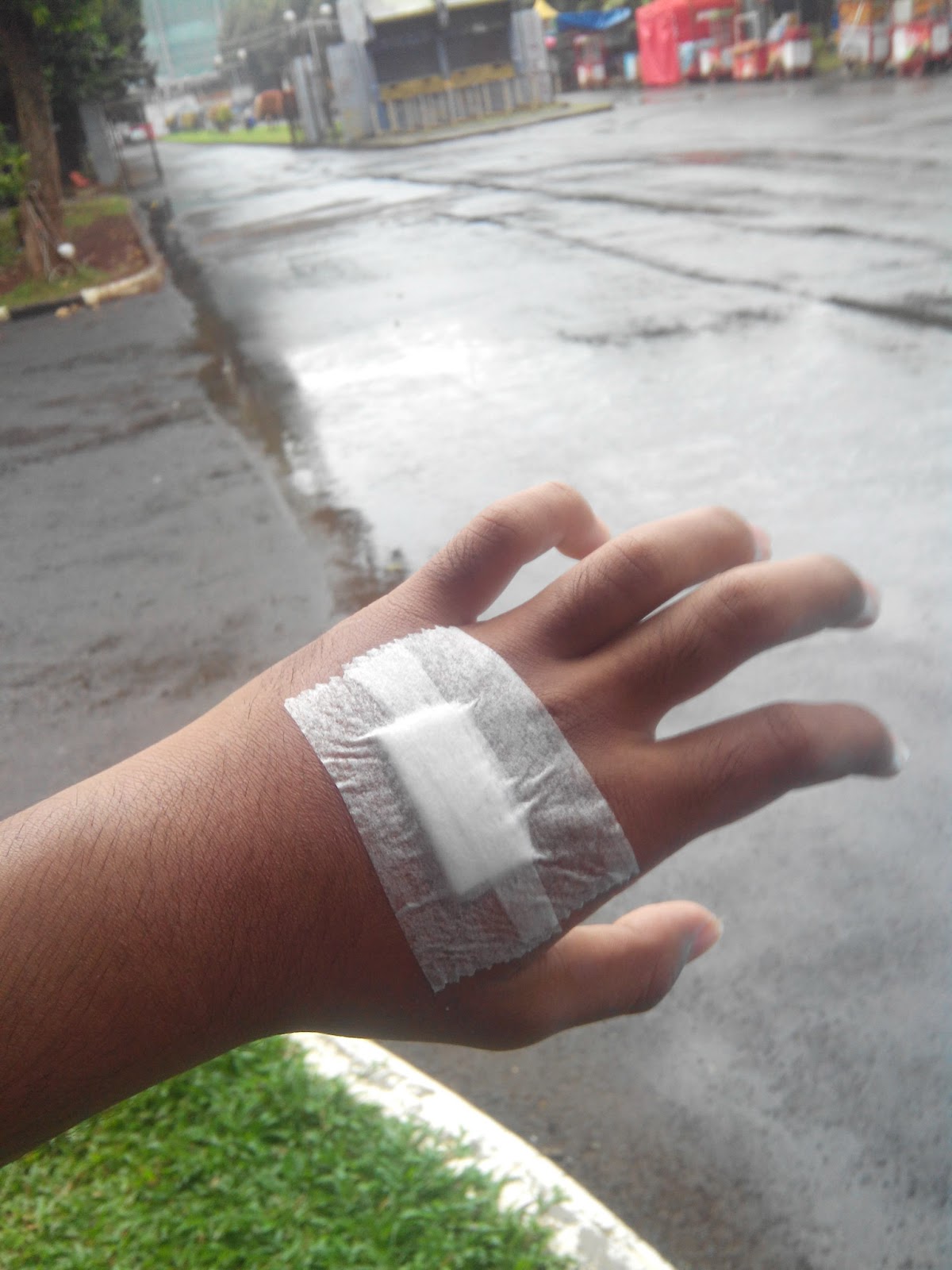 Kurus Gambar Tangan Di Infus Di Rumah Sendiri Penyeba - vrogue.co