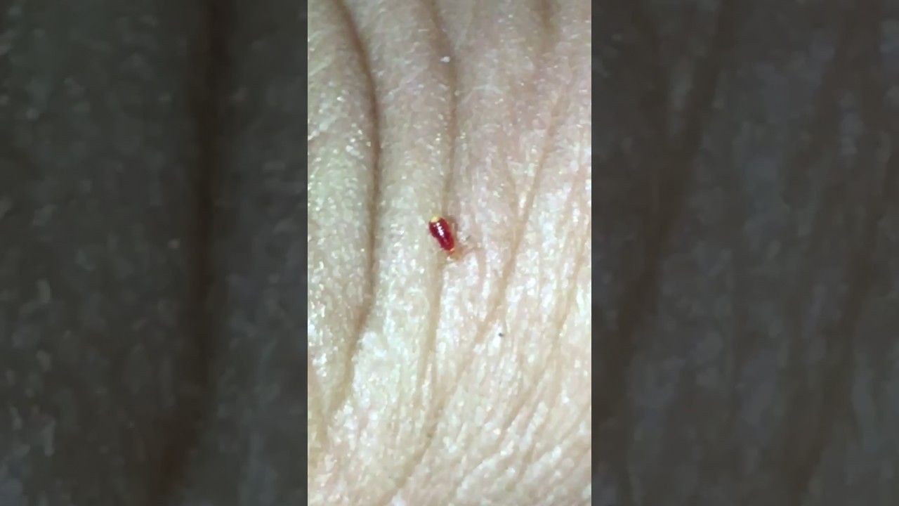 baby bed bugs baby bed bugs