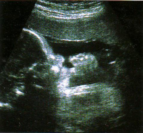 Узи 40 недель. УЗИ 34 недели беременности. УЗИ плода на 34 неделе беременности. Фото 34 недели беременности УЗИ плода.