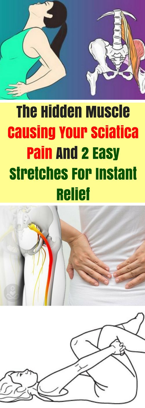 The Hidden Muscle Causing Your Sciatica Pain And 2 Easy Stretches For