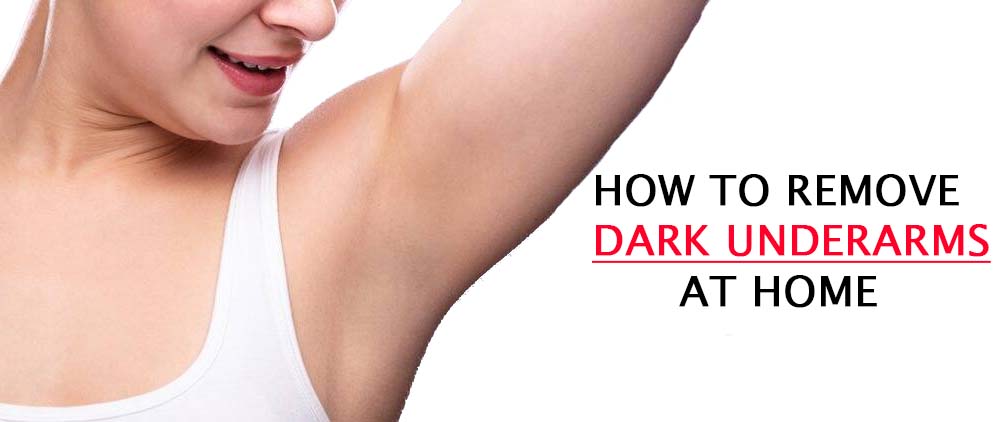 How to Remove Dark Underarms at Home