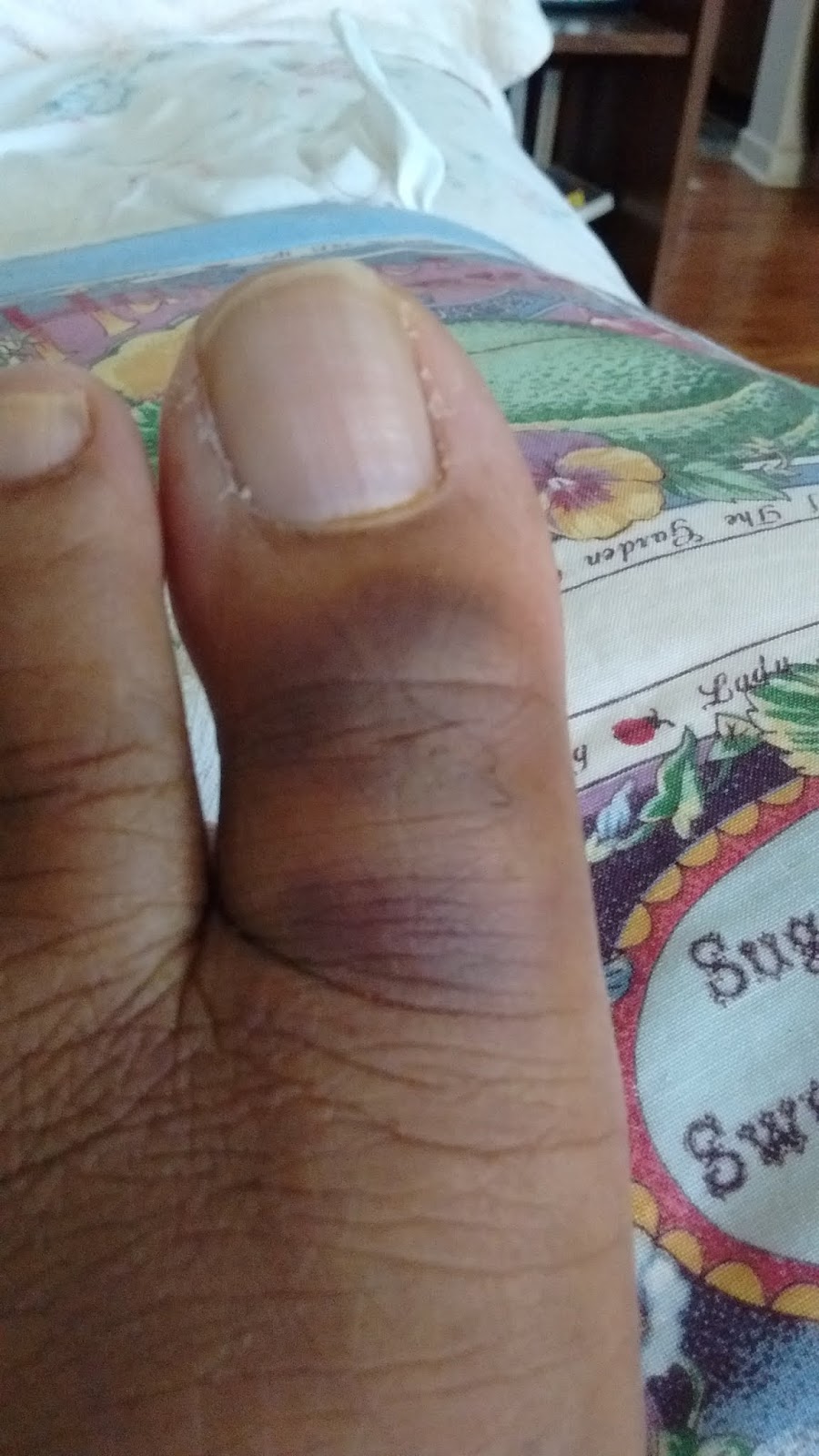 My Two Cents Bruised Toes and Doctor's Appointment