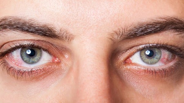 Signs of Eye Cancer and How to Avoid it Signs of Eye Cancer and How to Avoid it