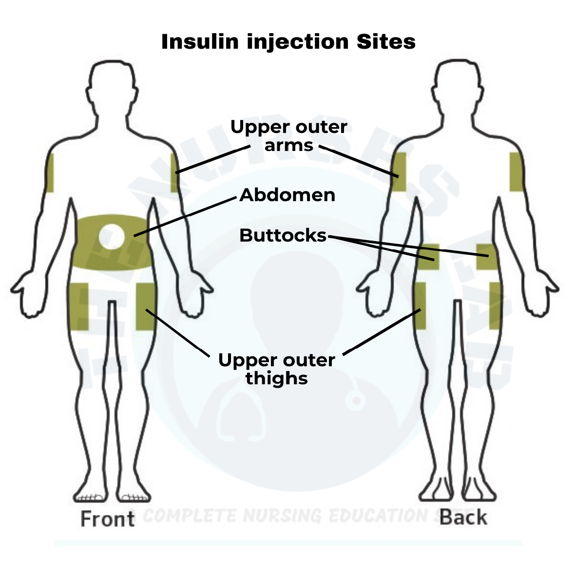Printable Insulin Injection Site Rotation Chart