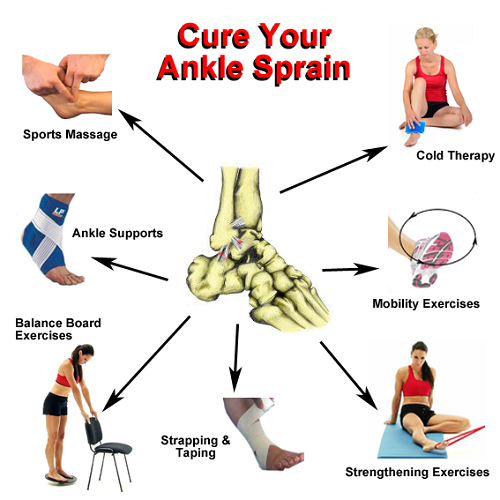 Physical Therapist's Guide to Ankle Sprain Physical Therapy