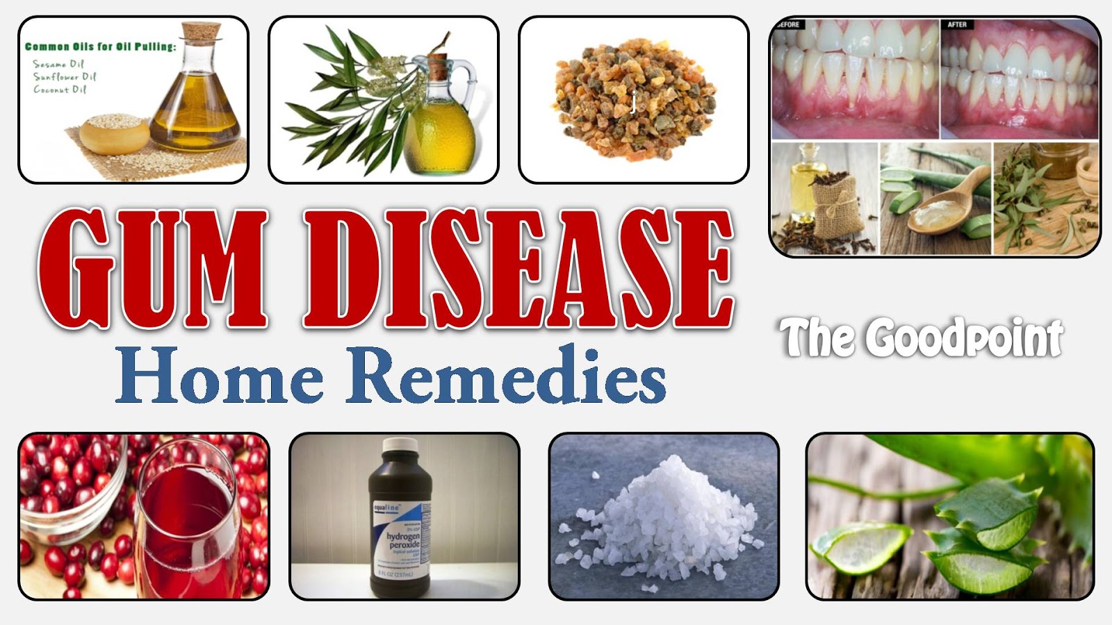 Home Remedies for Gum Disease TheGoodPoint The Good Point