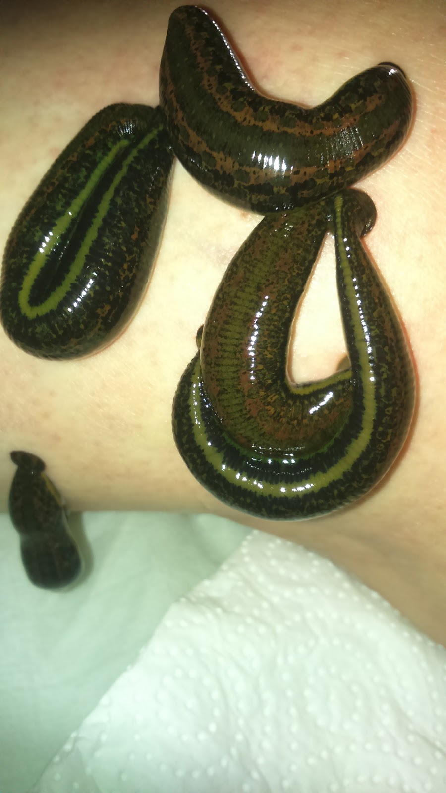 Bernadetts Blog Heilpflanzen und mehr Der Blutegel (Hirudo medicinalis)