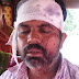 लक्ष्मीपुर : चापाकल गडाने को लेकर विवाद में हुई मारपीट, दो जख्मी 