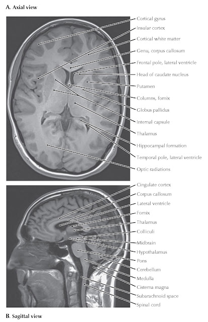 BRAIN IMAGING: MAGNETIC RESONANCE IMAGING, AXIAL AND SAGITTAL T1-WEIGHTED IMAGES