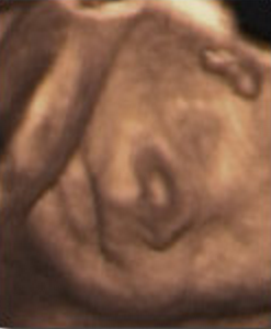 Hafta hafta bebeğin ultrason görüntüleri-27.hafta