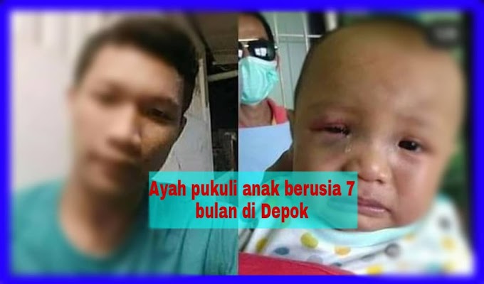 Bapa pukul anak 7 bulan kini jadi buruan. Foto muka bayi lebam bikin netizen berang!